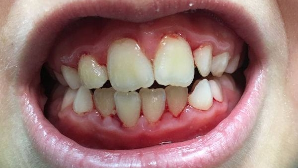 Salud dental II