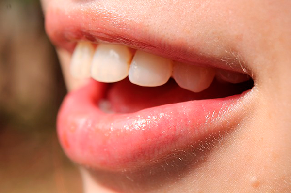 Consejos dentales III