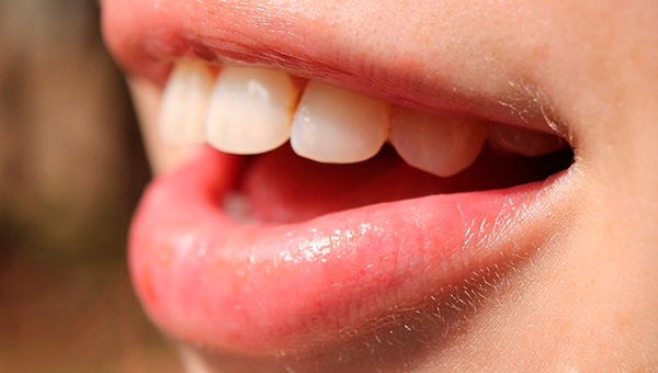 Consejos dentales III
