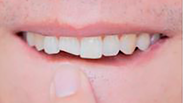 Consejos dentales I