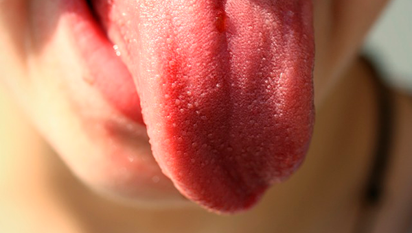 Molestias bucales