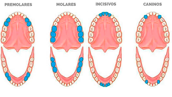 Tus dientes II