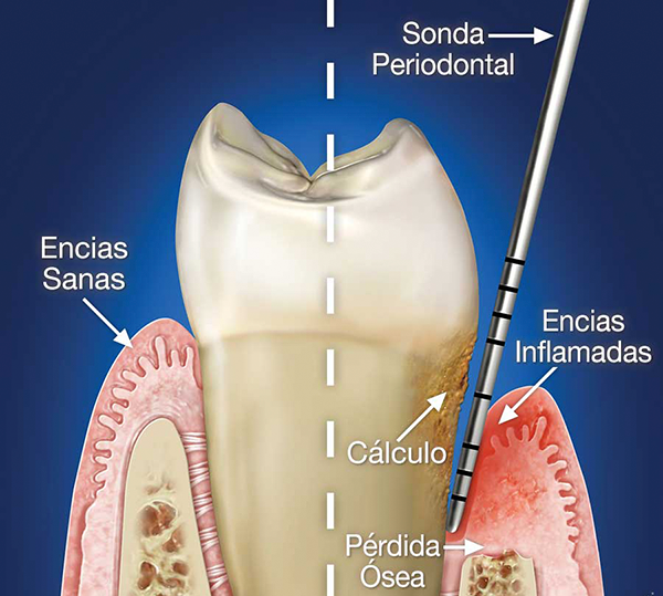 Higiene dental V