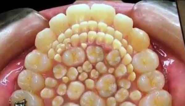Curiosidades dentales VI 