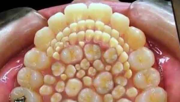 Curiosidades dentales VI 