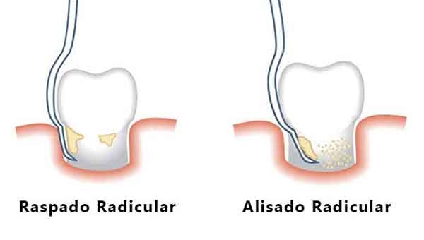 Salud dental XII 