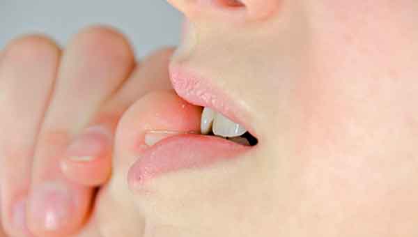 Consejos dentales IX