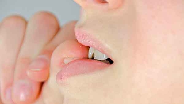 Consejos dentales IX