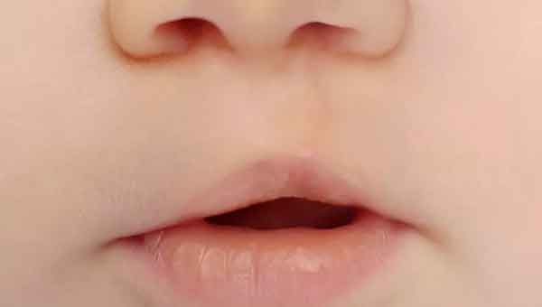 Odontopediatría VII