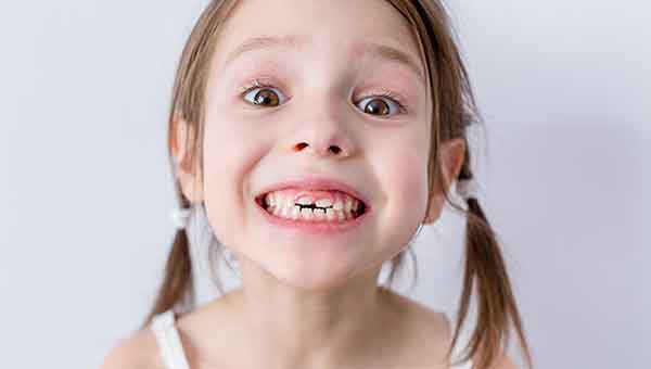 Dientes de leche