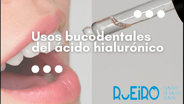 El ácido hialurónico