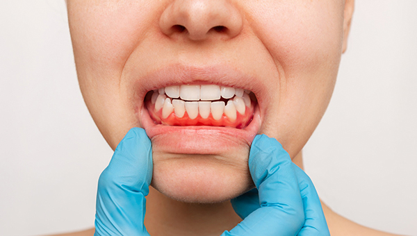 Salud bucodental XXXIII