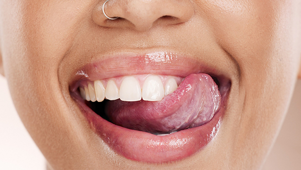 Higiene Dental XXXIV