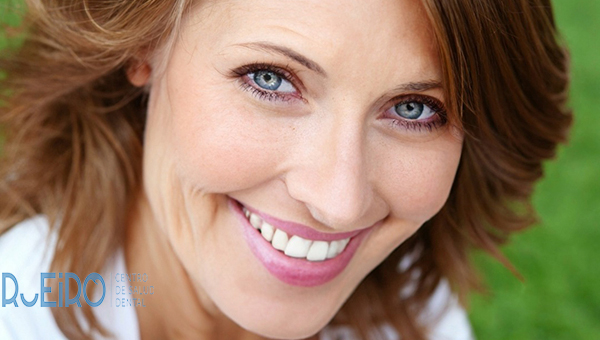 Estética dental III
