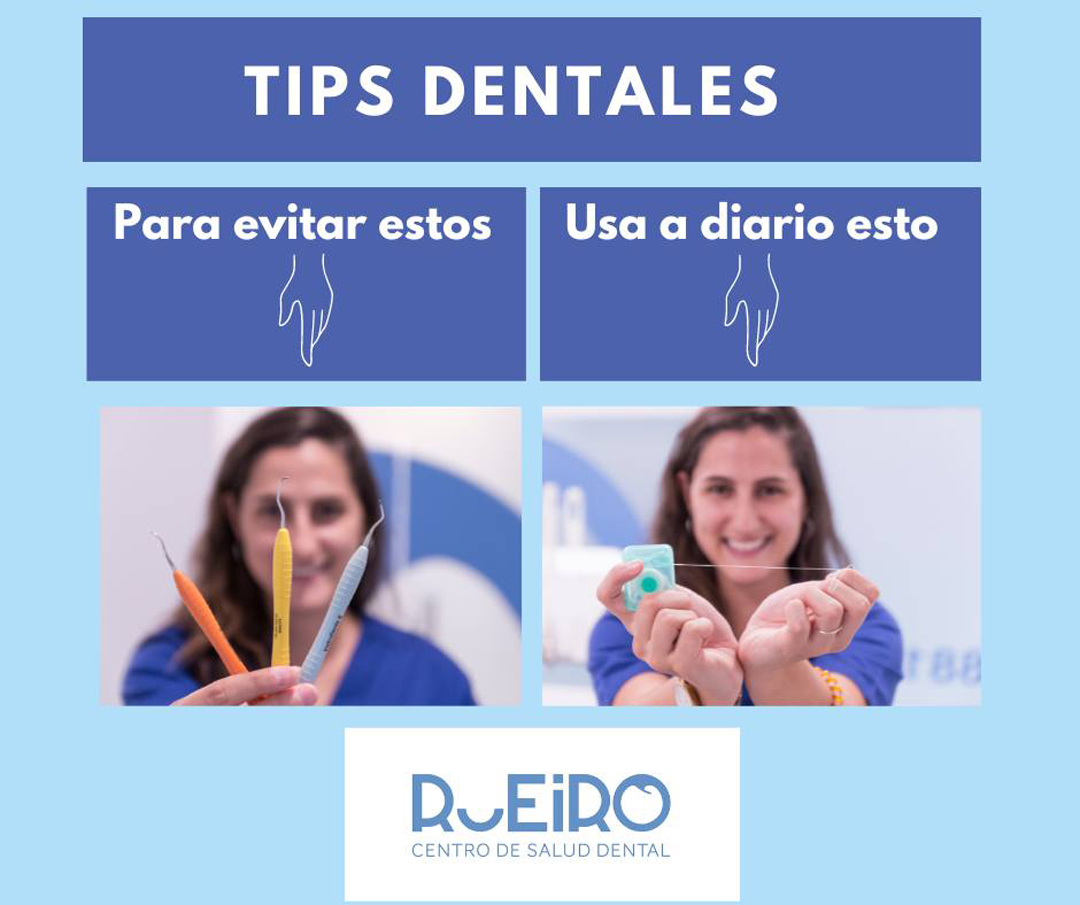 tips tips